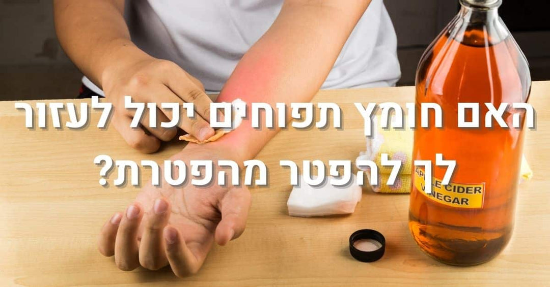 האם חומץ תפוחים יכול לעזור לך להיפטר מהפטרת?