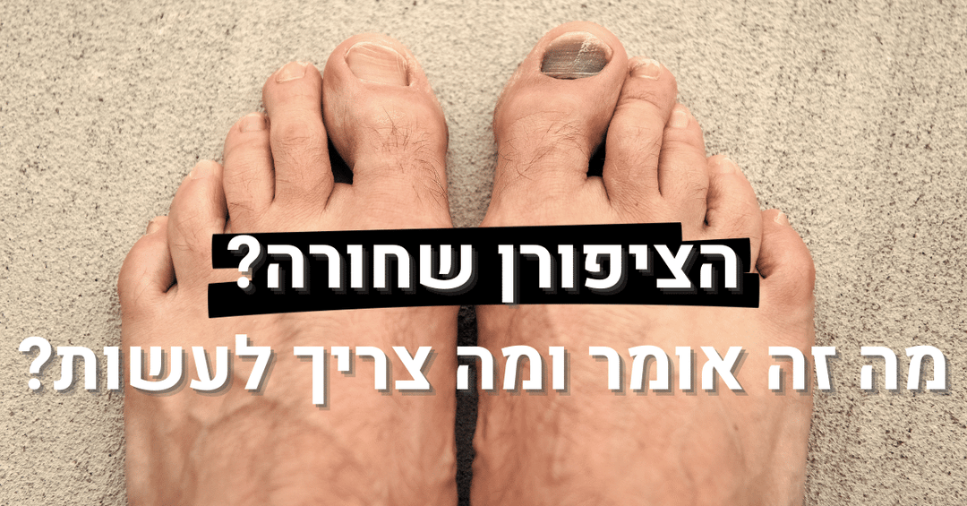 הציפורן שחורה? מה זה אומר ומה צריך לעשות