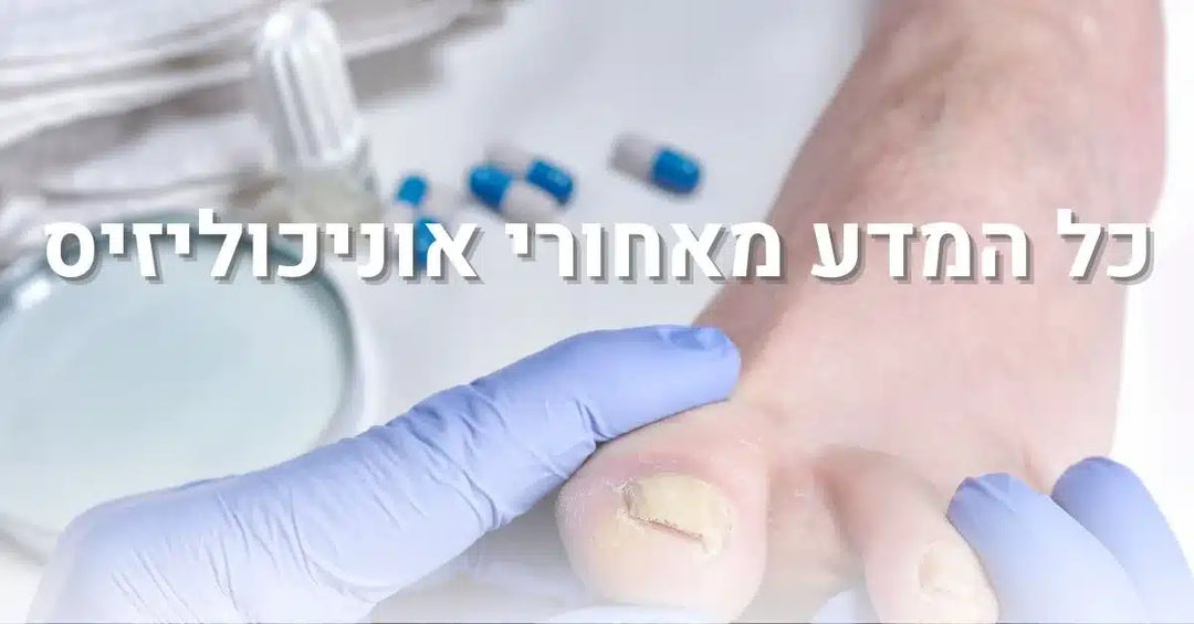 כל המדע מאחורי אוניכוליזיס